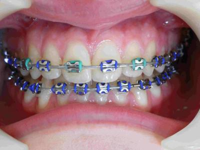 orthodontiste Bagnolet Les Lilas